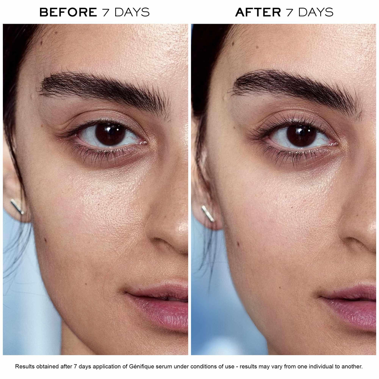 Lancôme Advanced Génifique Radiance Boosting Anti-Aging Face Serum - Visibly Hydrates & Plumps Skin - with Bifidus Prebiotic, Hyaluronic Acid & Vitamin Cg, 3.8 Fl Oz