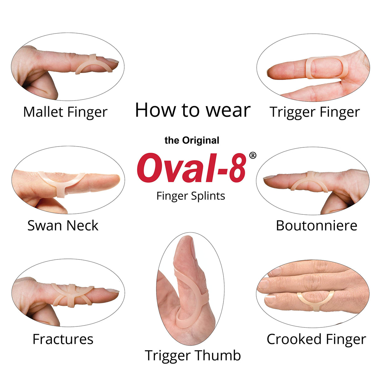 3-Point Products Oval-8 Finger Splints, Support and Protection for Arthritis, Trigger Finger or Thumb, and Other Finger Conditions Size 10 (Pack of 5)