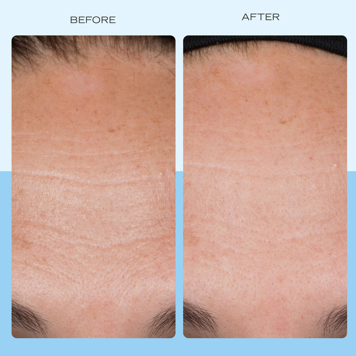 First Aid Beauty - Firming Collagen Cream with Peptides & Niacinamide, Ultra-Rich Plumping Moisturizer, Hydrates & Visibly Firms, Non-Comedogenic, Safe for Sensitive Skin, 3.5 oz