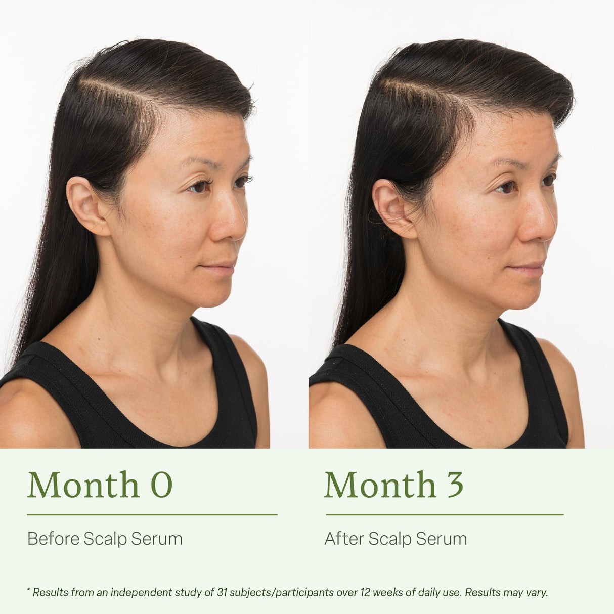 Divi Scalp Serum, Clinically Tested Hair Growth Formula, for Fuller and Thicker Hair - 30ml - 2 Pack