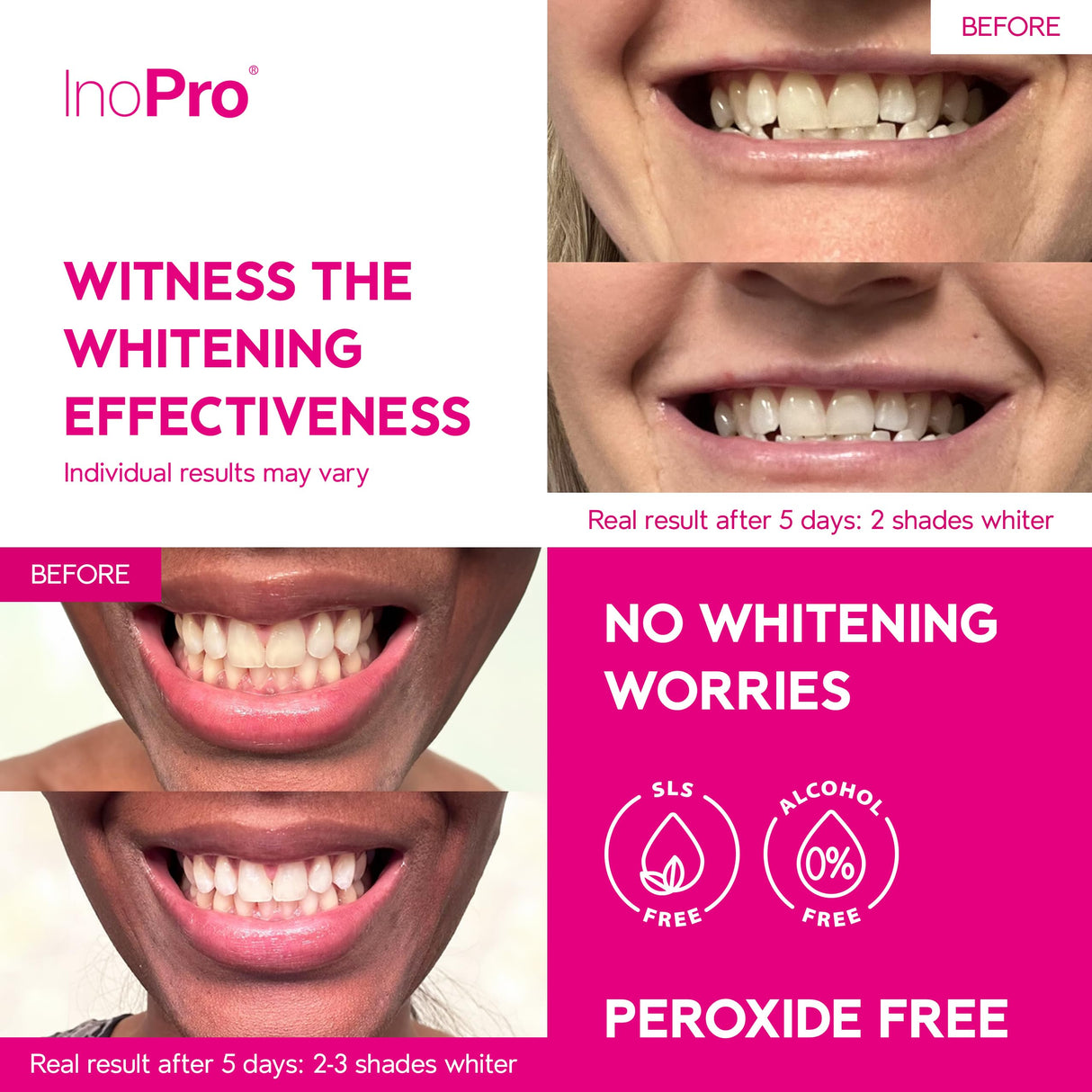 InoPro Teeth Whitening Strips 21 Treatments Kit - Teeth Whitener, Peroxide Free, Enamel Safe Green Whitestrips, Deep Stains Removal - Instant Teeth Whitening Without The Harm (42 Strips)