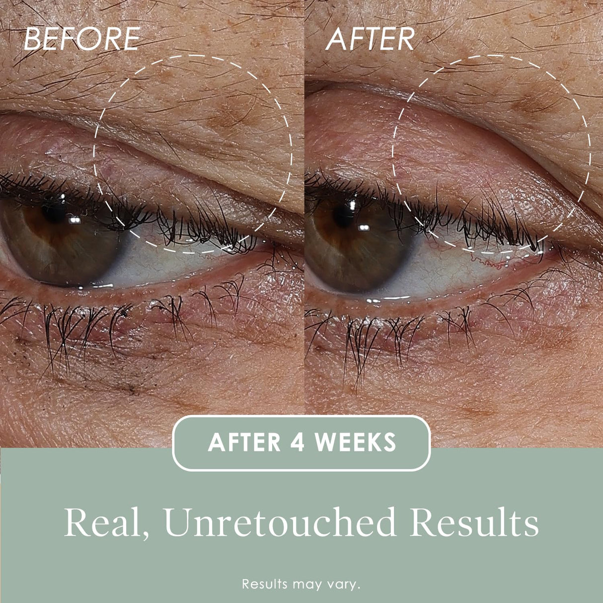 Crepe Erase Lift & Smooth Eyelid Treatment, Eye Serum, Anti-Aging Skin Care for Tightening, Firming, Lifting, Plumping and Waking up Tired Eyes, Supports Wrinkle & Crepe Skin on Eyelids, 0.77 FL Oz