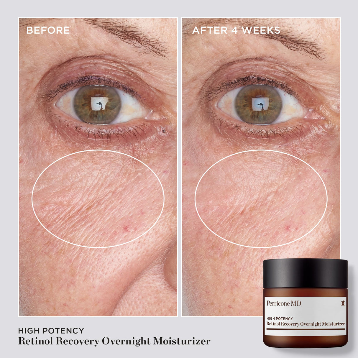 High Potency Retinol Recovery Overnight Moisturizer, 2 fl. oz.