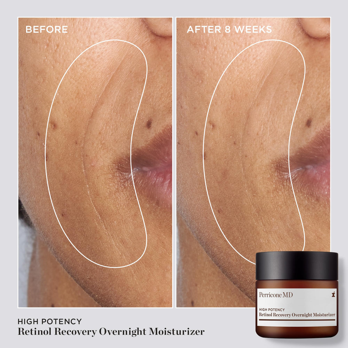 High Potency Retinol Recovery Overnight Moisturizer, 2 fl. oz.