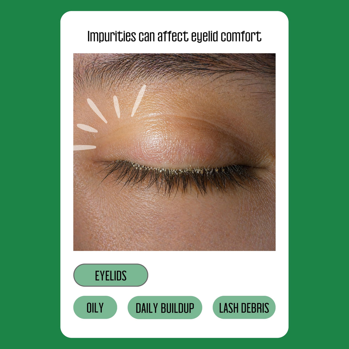 PURELID 100PCs Tea Tree Eyelid Wipes – Cleaning Eye Wipes for People with Dry Eyes & Allergies – Gentle Eyelid Cleanser with Hyaluronic Acid, Chamomile and Aloe – Individually Wrapped & Biodegradable