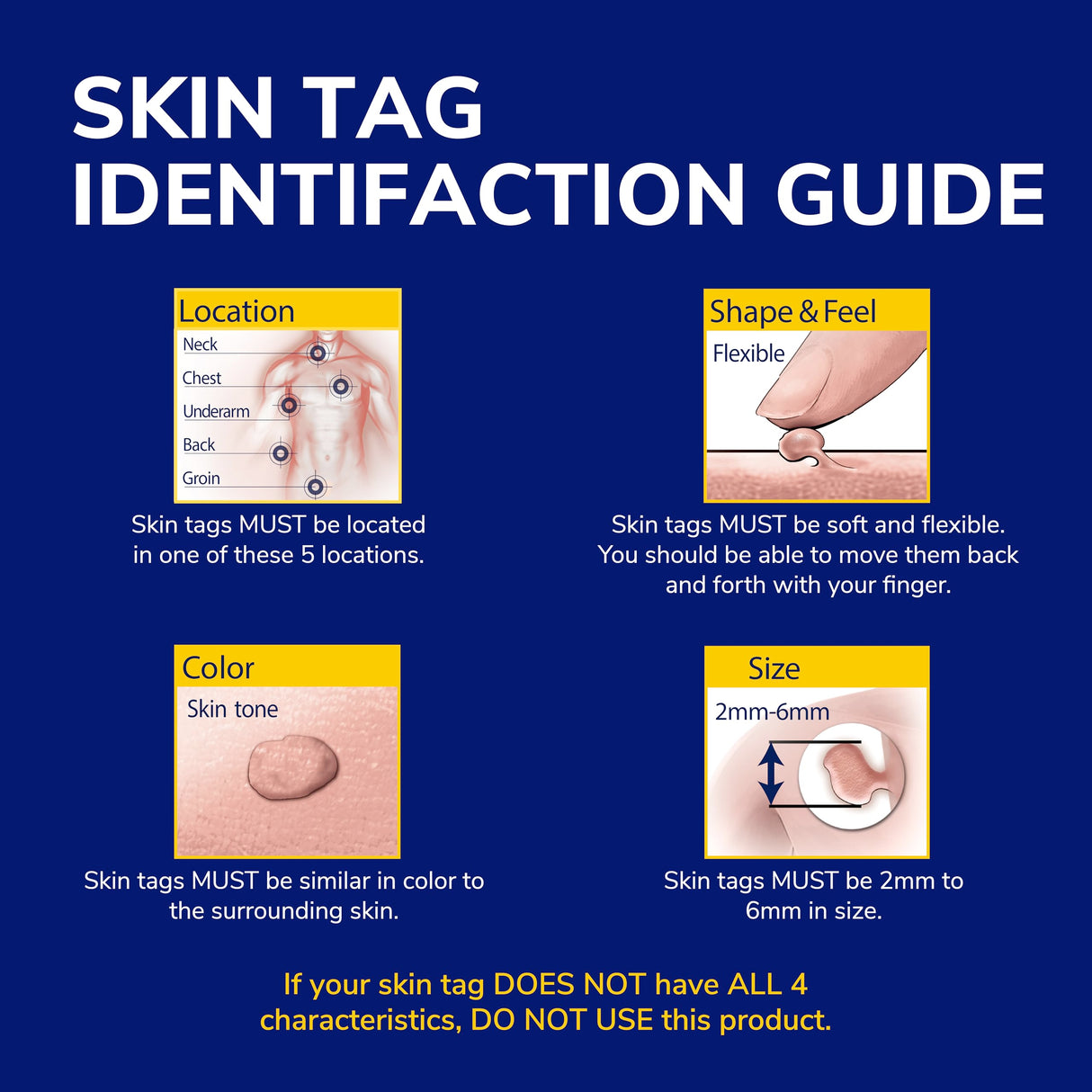 Dr. Scholl's Freeze Away Skin Tag Remover - The First FDA Cleared, at Home Skin tag Removal kit. Clinically Proven Skin tag Removal in as Little as 1 Treatment. 1 Skin tag Removal kit, 8 Treatments.