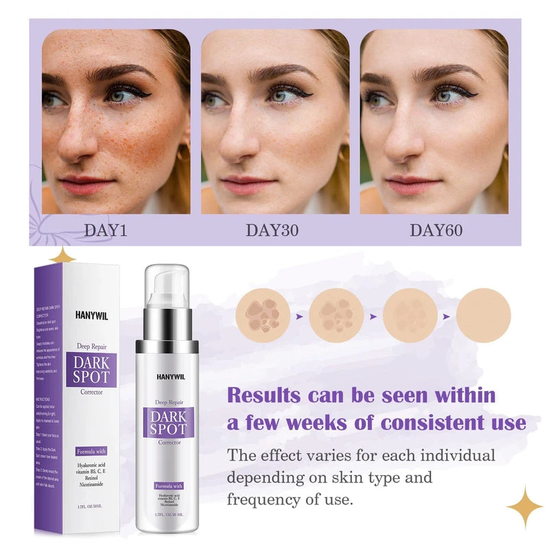 HANYWIL HANYWIL Dark Spot Remover for Face and Body, Dark Spot Corrector Cream, Skin Brown Spot Remover, Skin Care Face Cream, Sun Spot Remover, Age Spot Corrector, Rapid Tone Repair Retinol (1.7 Fl Oz)