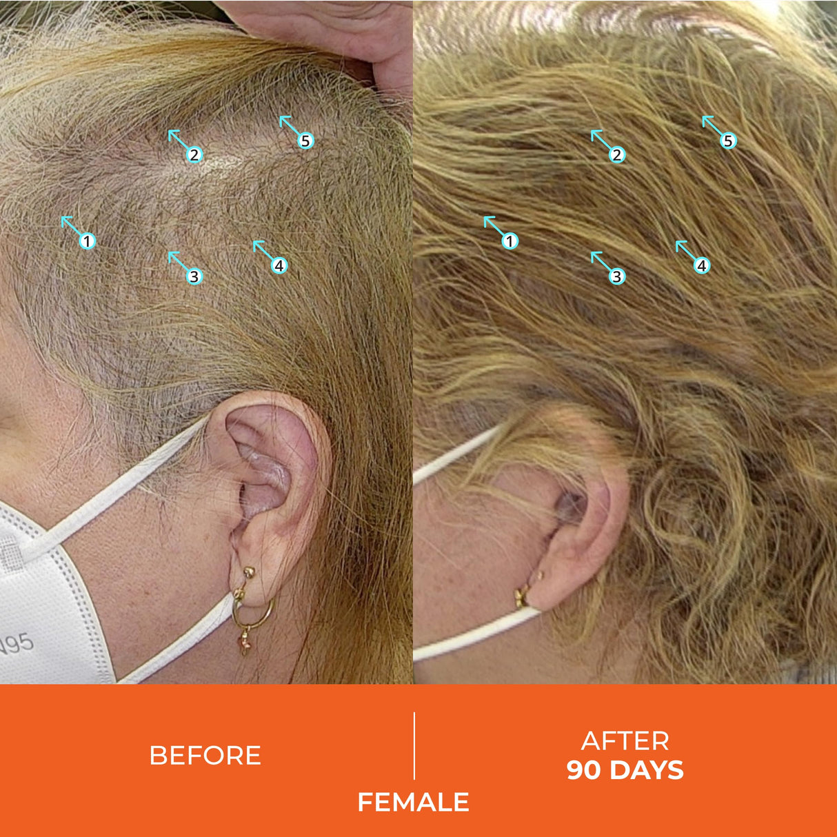 DS Labs Revita Tablets - Hair Vitamins for Density Support, Supplement for Thicker, Stronger Looking Hair, Zinc, Iron, Magnesium, Melatonin, Vitamin D & Biotin Vitamins for Women & Men, 90 Tablets