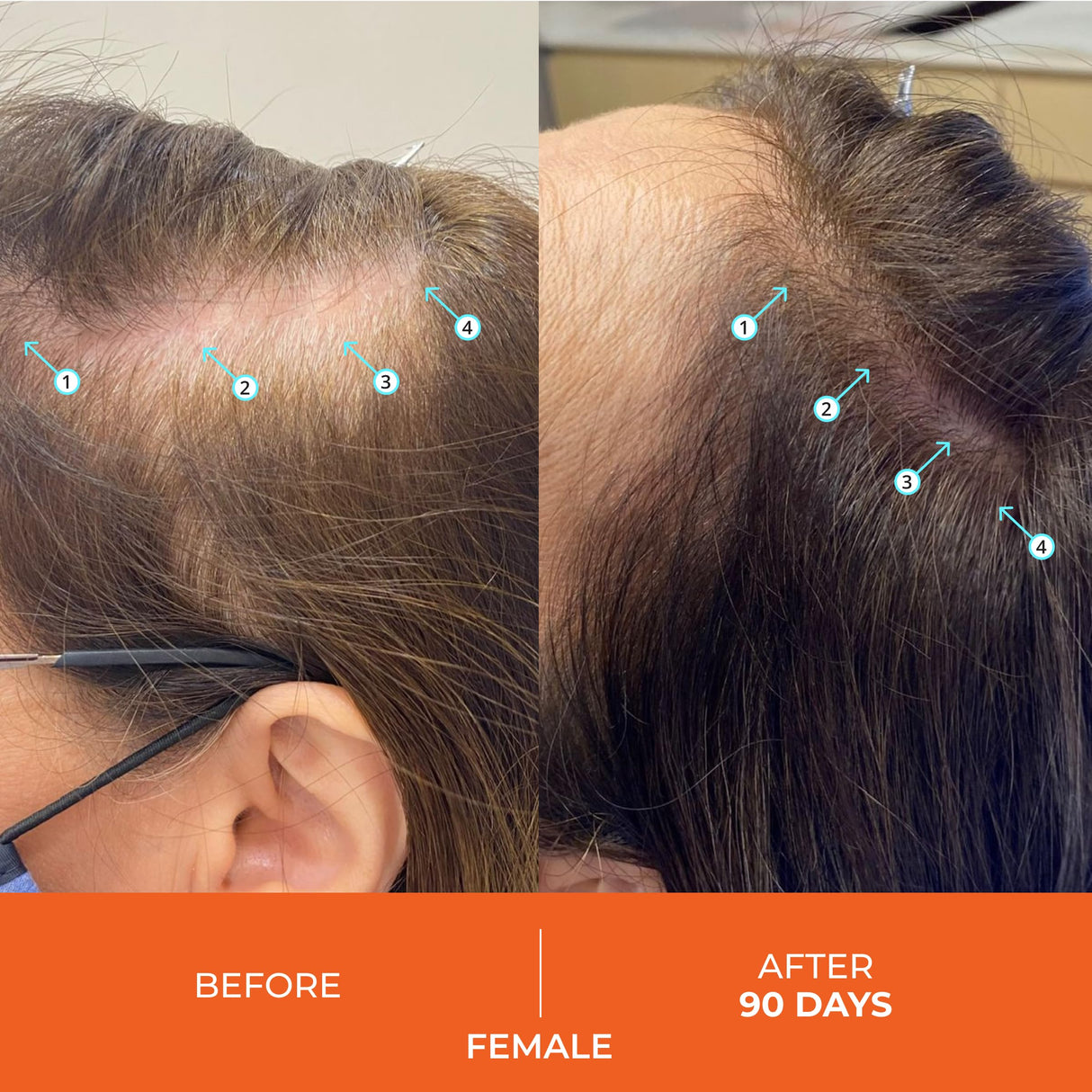 DS Labs Revita Shampoo and Conditioner – High-Performance Hair Density Kit, Volumizing, Thickening, Fuller, Sulfate & Silicone Free, For Men & Women, 925mL, Packaging May Vary