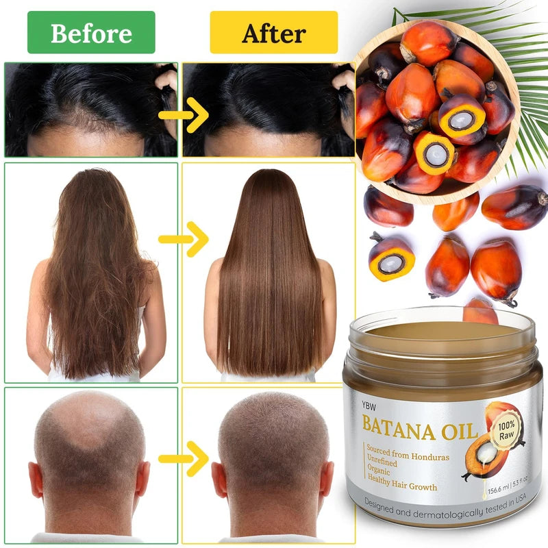 Dr. Sebi Batana Oil 100% Natural, Unrefined & Organic from Honduras for Hair Growth, Improves Hair Thickness, Prevents Hair Loss for Men & Women