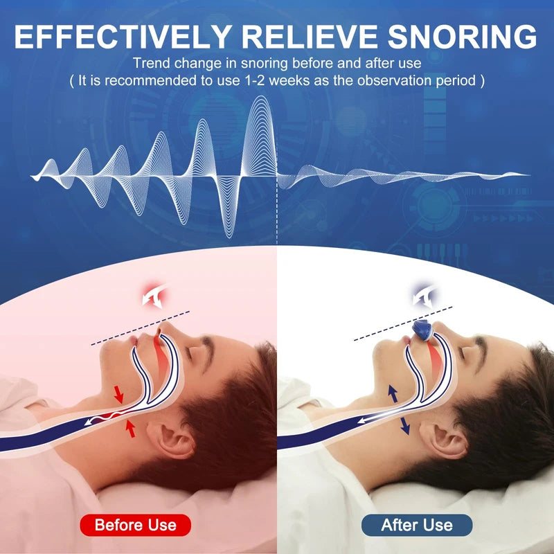 Anti Snoring Device, Adjustable Wind Speed Snoring Solution, Electric Anti Snoring Devices Nasal Dilator Nose Vents Plugs,Stop Snoring Suitable for Men and Women 003