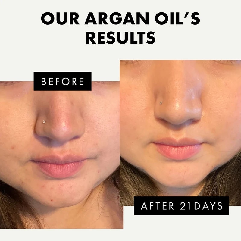 ORGANIC Argan Oil - 100% Pure/Unrefined/Extra-Virgin/Vegan - HAND-HARVESTED & COLD PRESSED in Morocco - Perfect for Skin/Hair/Nails/Face/Body - GMP-Certified/Dermatologist Approved