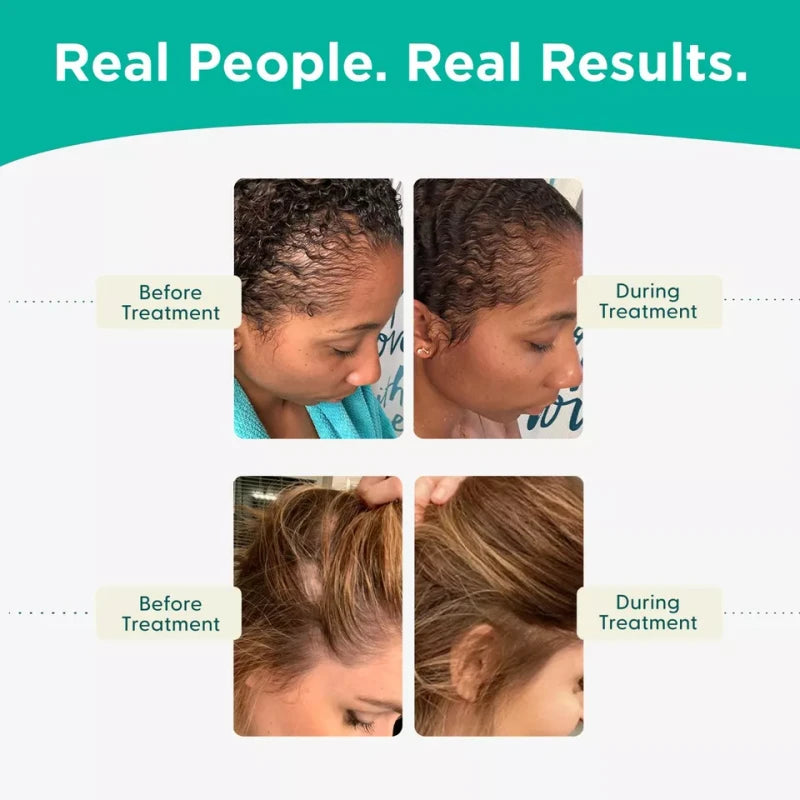 Shapiro MD Hair Loss Shampoo & Conditioner – Vegan DHT-Blocking Formula for Thicker, Fuller Hair