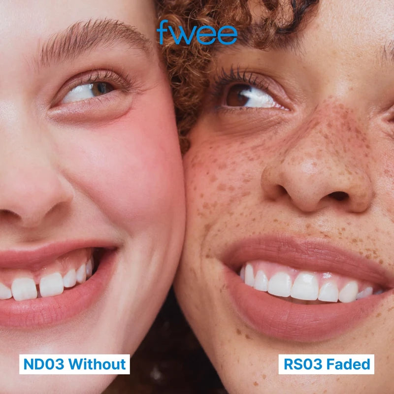 fwee Blurry Pudding Pot | Airbrushed Blush & Lip, Buildable Pigment, Long-lasting, Lightweight, Easy to Blend, Natural Soft Matte Finish - Faded (Dusty Rose) | 0.17 oz