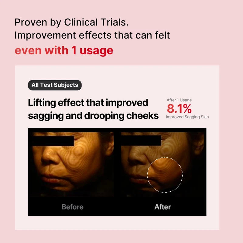 MEDITHERAPY Shumage Gold Seal Lifting Cream+Device, Ultimate Lifting and Tightening for Sagging Skin, Facial Device for Radiant Glow Skin, Elasticity, Anti-Wrinkle