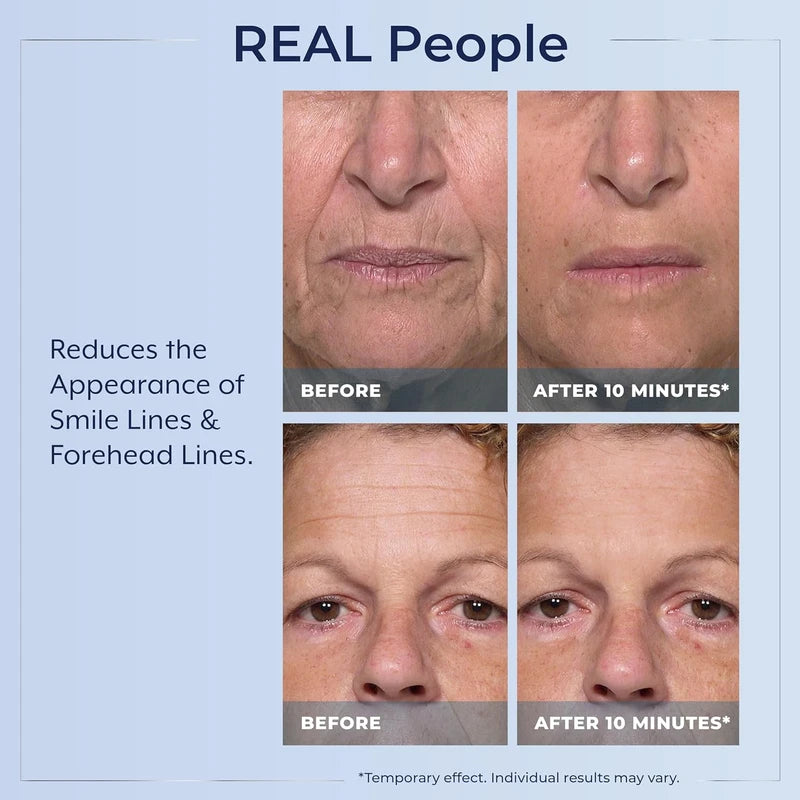 Plexaderm Rapid Reduction Eye Serum - Advanced Formula Anti Aging Visibly Reduces Under-Eye Bags, Wrinkles, Dark Circles, Fine Lines & Crow's Feet Instantly Instant Wrinkle Remover for Face