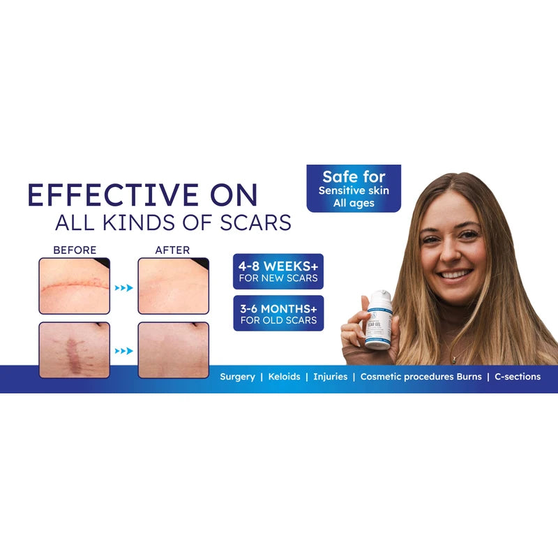 ZaynAura Advanced silicone Scar Gel 1.7floz (medium)