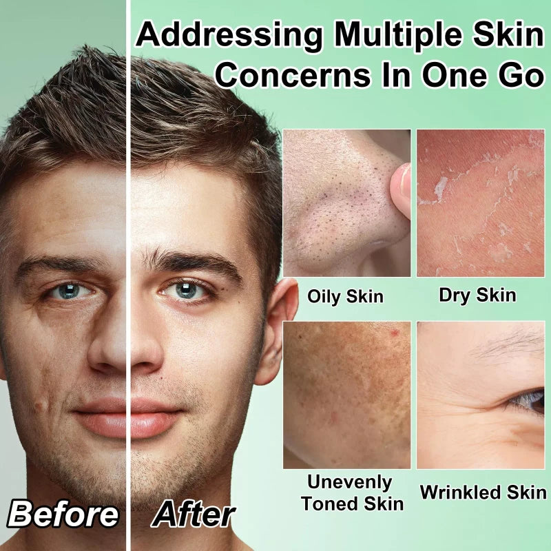 GOWLAVER All In One Men's Skin Care Set Facial Cleanser Toner Scrub Serum Moisturizer