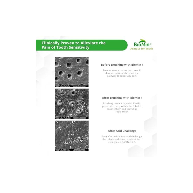 BioMin F Toothpaste - Helps Strengthen & Protect Enamel, Provide Relief to Sensitive Teeth - 75ml Mild Minty Flavour Fluoride Toothpaste for Adults & Kids - Suitable for Vegans, Not Tested on Animals