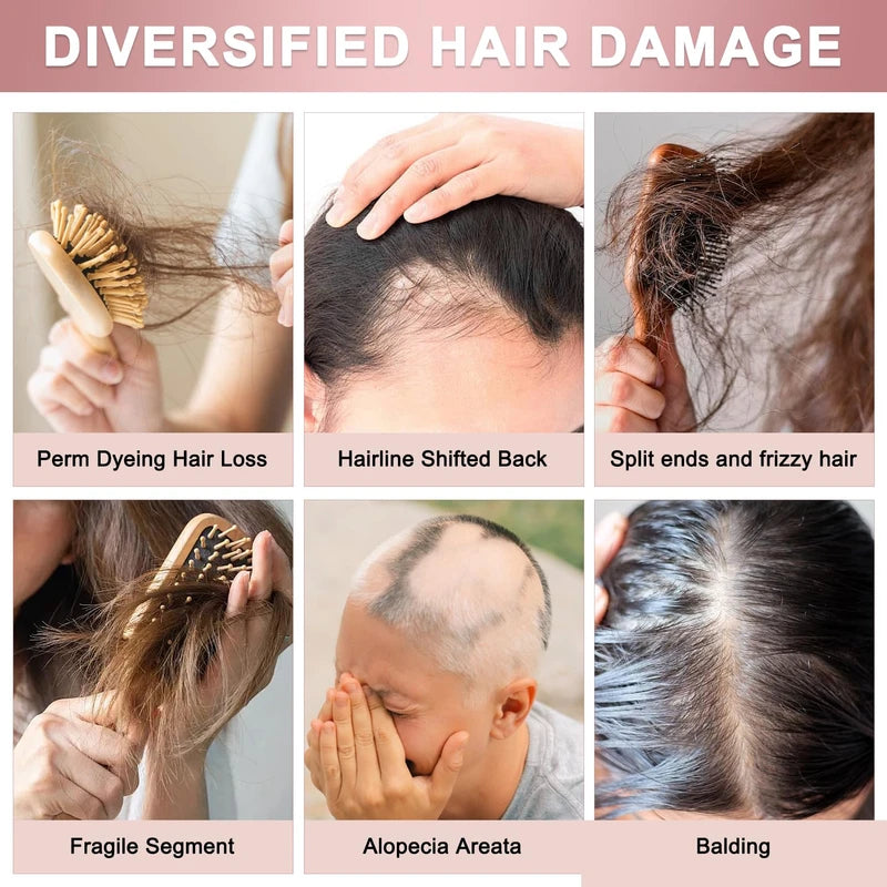 2PCS Hair Regrowth Rice Nutri Spray,Rice Water Hair Growth Spray, Hair Helper Spray Biotin and Caffeine,Regrow 2.0 Hair Regrowth Rice Nutri Spray, Nutri Growth Spray for Stronger, Healthier Hair