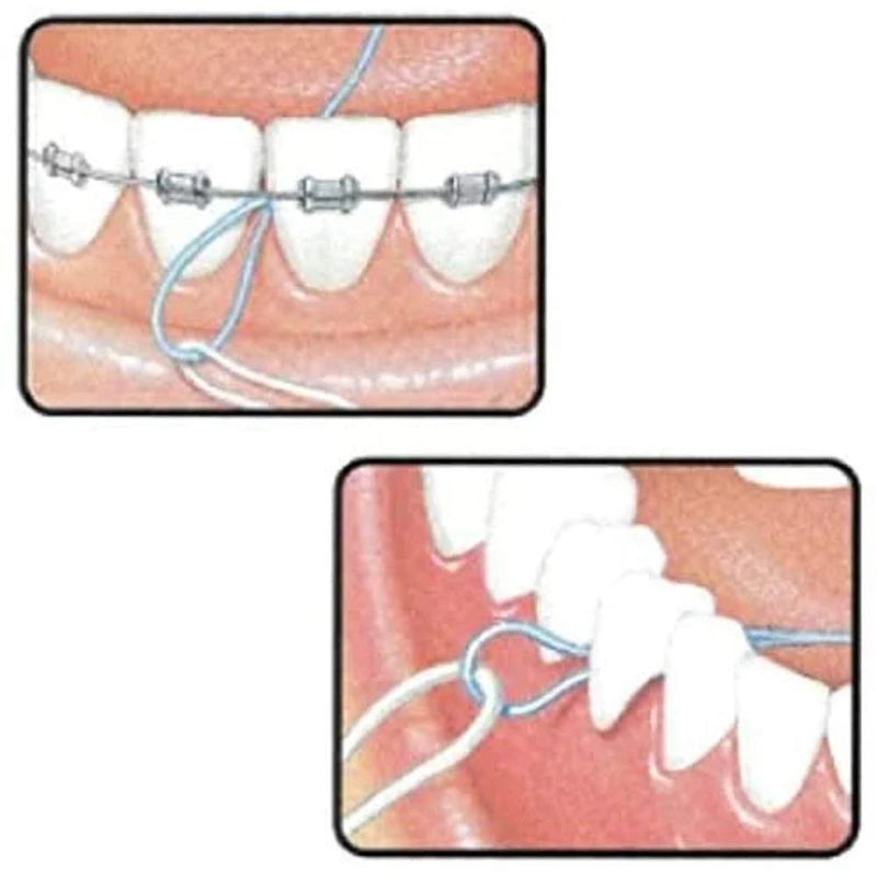 Butler Floss Threader, Pack of 5, Set of 10