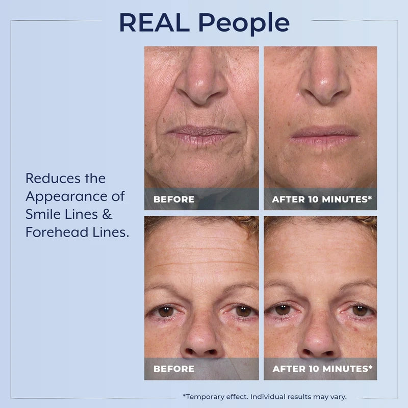 Plexaderm Rapid Reduction Eye Serum - Advanced Formula Anti Aging Visibly Reduces Under-Eye Bags, Wrinkles, Dark Circles, Fine Lines & Crow's Feet Instantly Instant Wrinkle Remover for Face