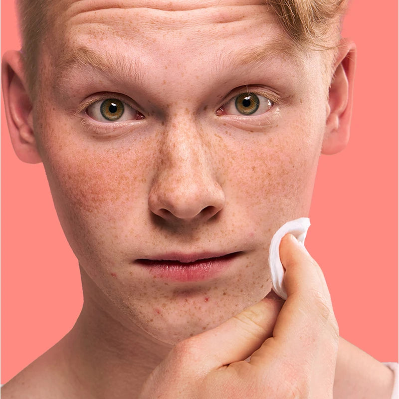 Clean & Clear Essentials Deep Cleaning Astringent, 235ml