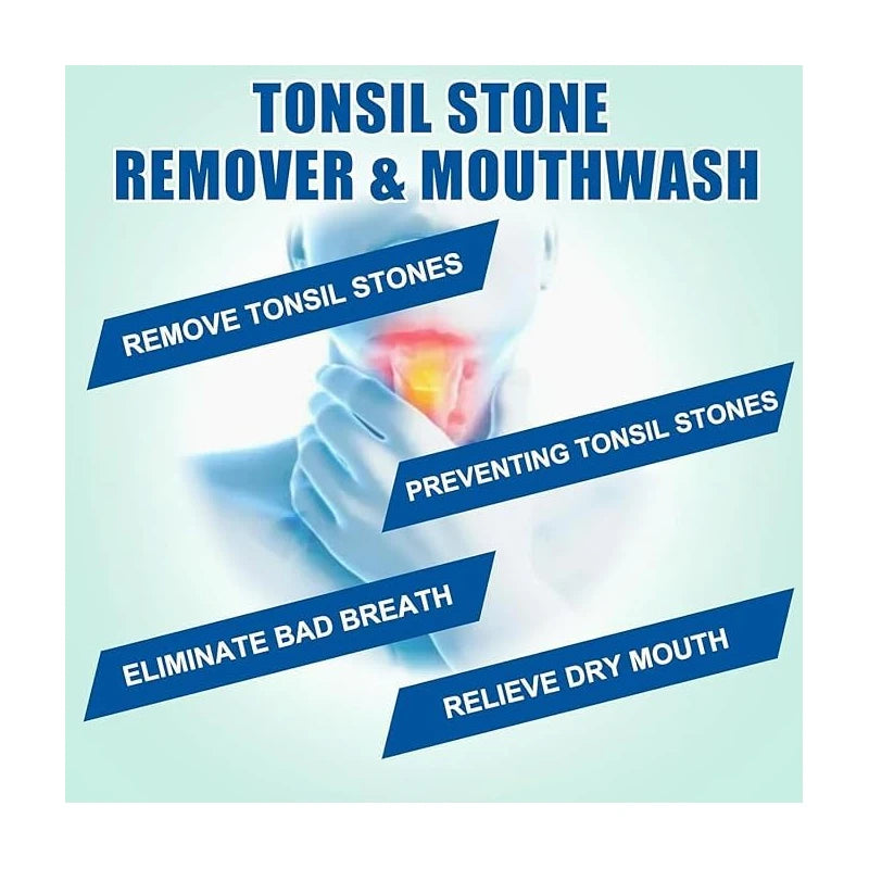 Tonsil Rinse-Tonsil Stone Remover Mouthwash,Natural Mouthwash Soothe Tonsils,Fight Bad Breath,Relieve Dry Mouth-Alcohol-Free,Breath Freshening,Mint Flavor-10 FL OZ