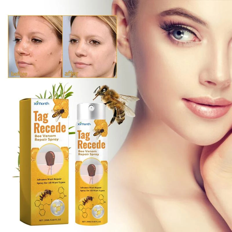 XIMonth Bee Venom Wart Treatment Spray Improve Flesh Moles Repair Smooth Skin Wart Spray - Specification: 1 pcs