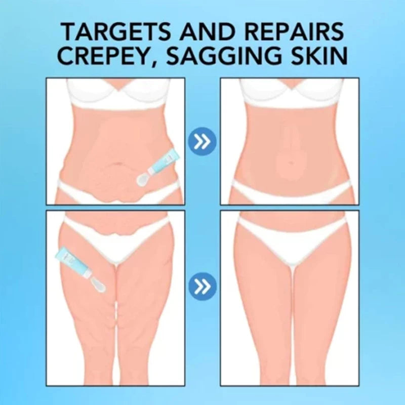 Turmeric Lift Skin Body Firming & Anti-Wrinkle Cream, Skin Firming Youth Butter, Skin Firming and Tightening Lotion, Skin Firming Youth Butter, Anti-Ageing Skin Firming Cream for Body Loose Skin, Pack