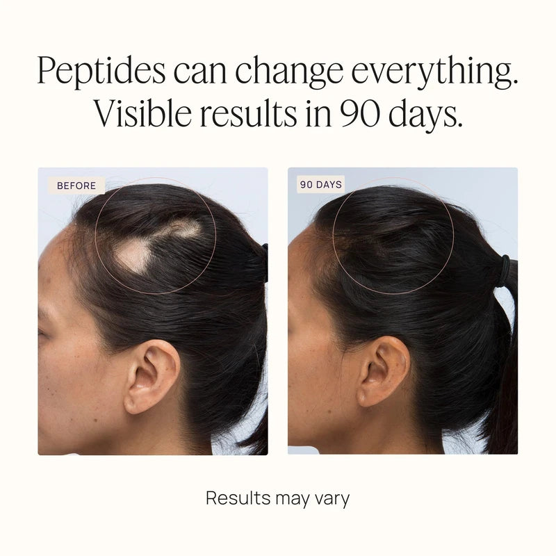 OMI WELLBEAUTY OMI WELLBEAUTY Women's Hair Growth Peptides Gummies, Doctor Recommended, Follicle Fortifying Biotechnology, Clinically Proven to Visibly Grow More Hair and Reduce Hair Loss, 1-Month Supply