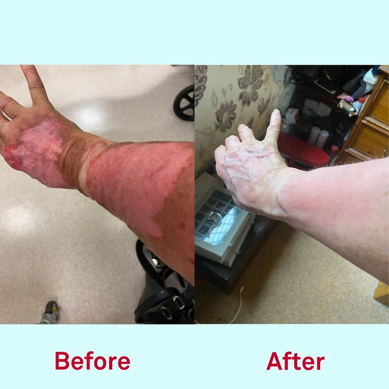 Nursem Caring Skin Fix – 50ml | Intensive Hand Treatment & Natural Barrier Cream for Dry, Sensitive Skin – Restores, Soothes & Protects Hard-Working Hands from Cracks & Irritation