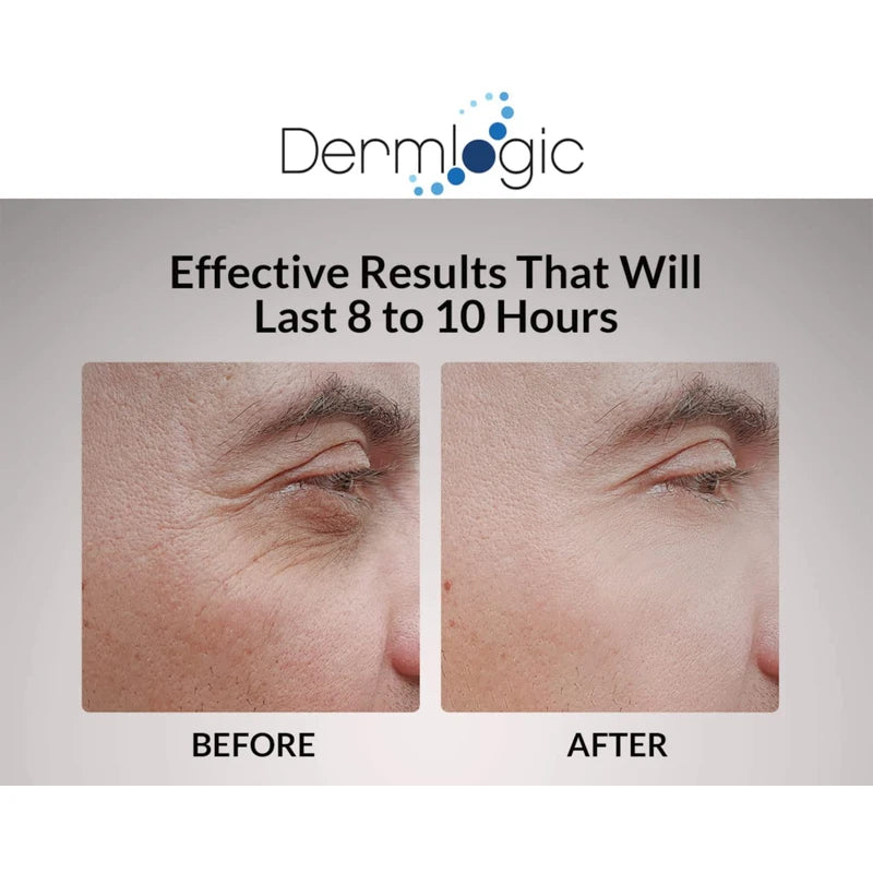 Under Eye Puffiness & Dark Circles Rapid Treatment- Instantly Reduces the Appearance of Puffy Eye Bags, Crow’s Feet, & Sagging Skin. Long Lasting Tightening & Firming Effect for Both Men & Women.