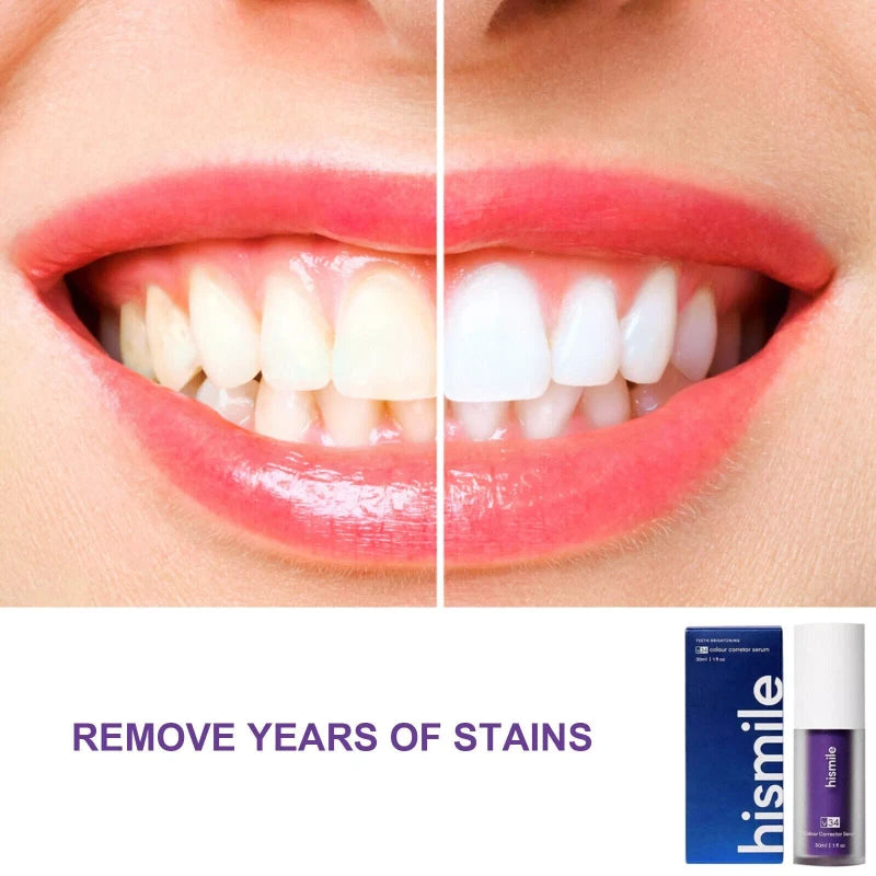 Hismile v34 Colour Corrector Serum Purple Teeth Whitening Tooth Stain Removal US