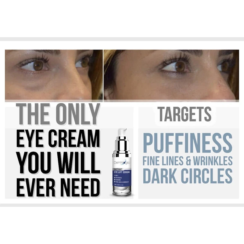 Under Eye Puffiness & Dark Circles Rapid Treatment- Instantly Reduces the Appearance of Puffy Eye Bags, Crow’s Feet, & Sagging Skin. Long Lasting Tightening & Firming Effect for Both Men & Women.