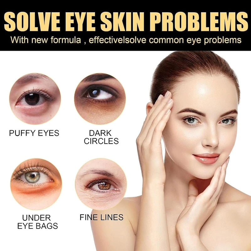 Celyn Instant Firm Eye Tightener, Ksndurn Eye Bag Cream - Reduce Eye Bags, Fade Fine Lines, Dark Circles, Tightens & Smoothes Fine Lines (2Pcs x 30ml)