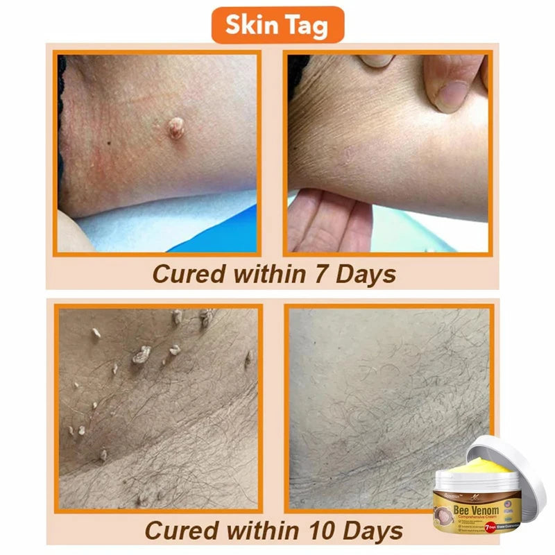 flysmus Bee Venom Comprehensive cream,flysmus Bee Venom Cream, Visibly reduces skin blemishes and smoothes skin (3)