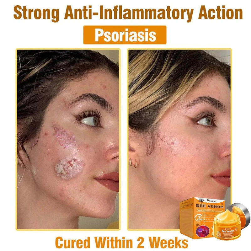 Daasry Bee Venom Skin Treatment Serum Cream, 2025 New Professional Bee Venom Skin Treatment Cream, Daasry Skin Repair Cream, Repair, moisturize and lift 3 in 1, for All Skin Types (3 Bottle)