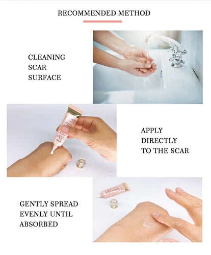 Yoxier Lavender Scar Repair Cream Anti Stretch Marks Cream Scar Removal Cream