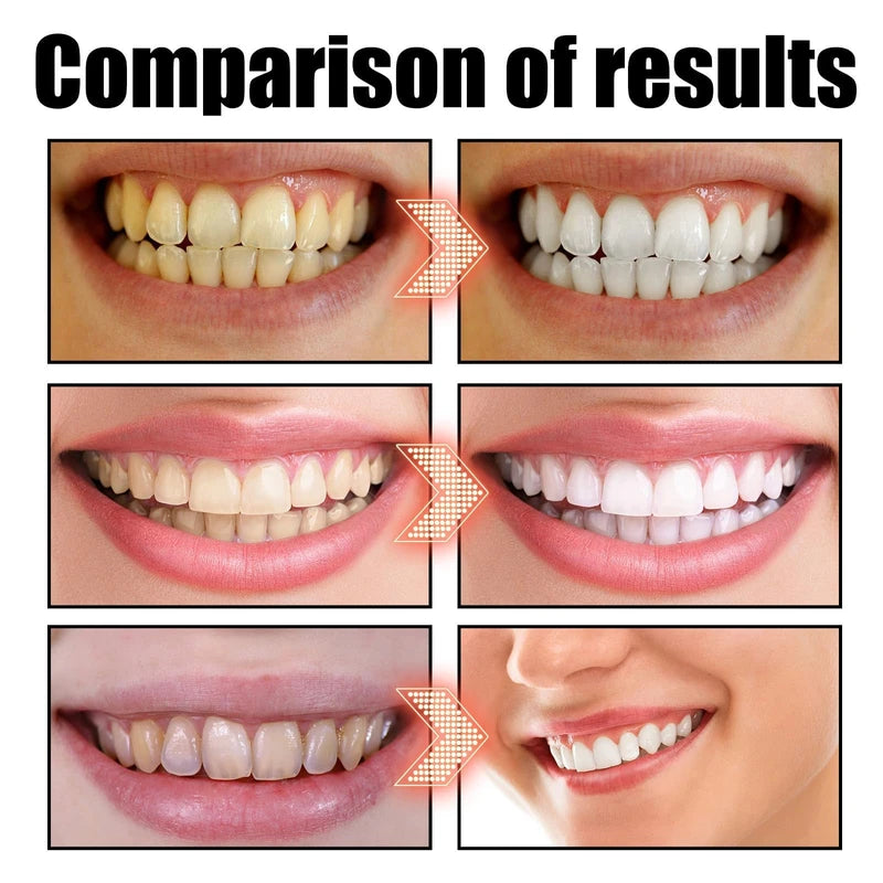 Zdiwond Coconut Oil Pulling for Teeth-Cocofresha Powerful Organic Coconut Peppermint Pulling Oil 4 Oz, Pulling Oil for Teeth and Gums, Pure Organic Coconut Oil Pulling Mint Freshness, Natural Cleanse (2)