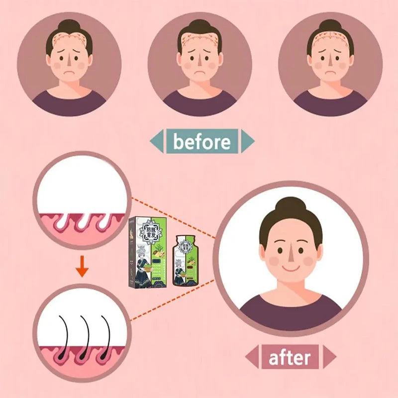 Ginger Anti Hair Loss Shampoo, Polygonum Multiflorum Ginger Plant Extract Anti-Hair Loss Hair Shampoo Ginger Hair Care Shampoo