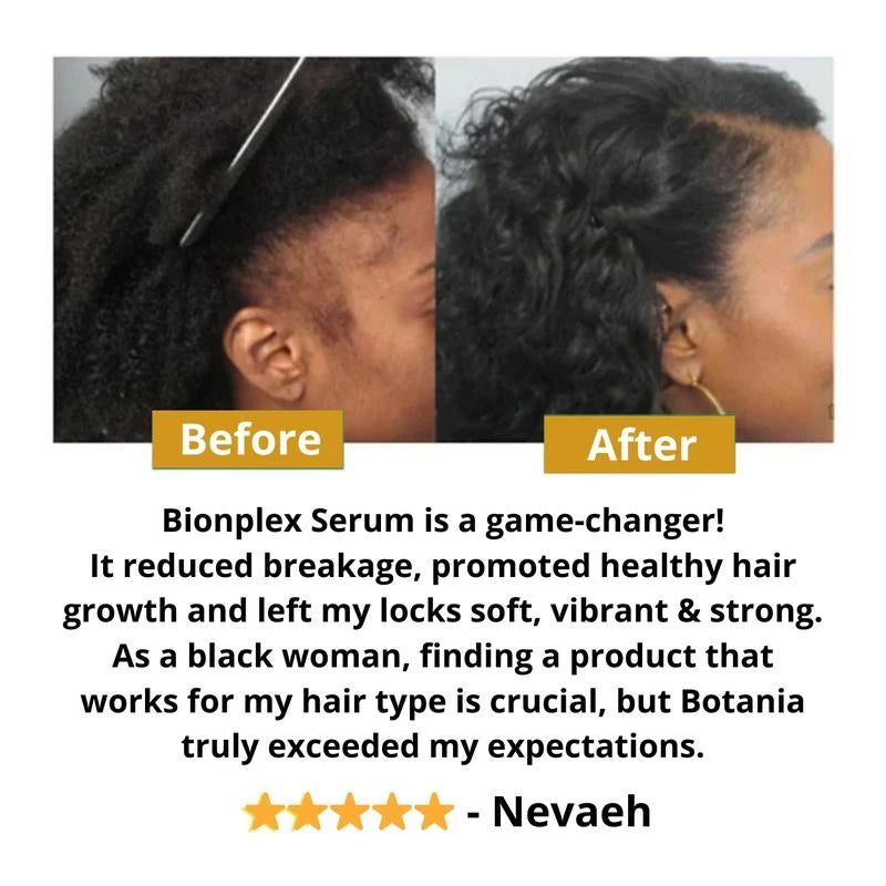 BIONPLEX 100% Organic Hair Growth Serum For Thinning Hair Loss - More Bottles:: 1 Pics