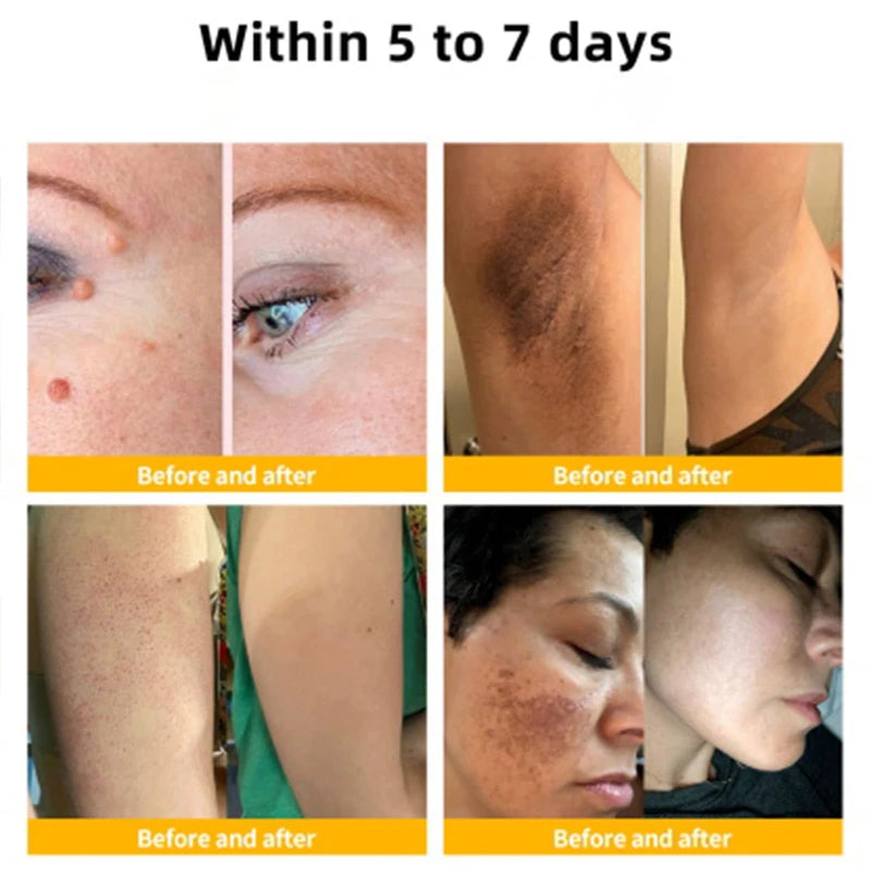 Bee Venom Comprehensive Cream, Professional Bee Venom Skin Treatment Cream for Removing and Repair, Natural Bee Venom Cream Suitable for All Skin Types (3PC)