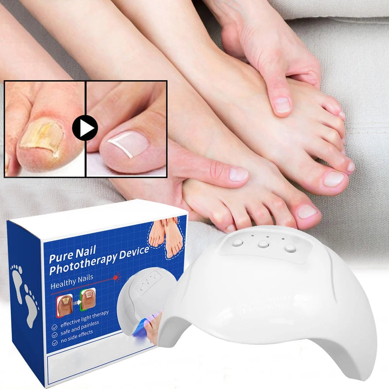 Light Therapy Nail Fungus Laser Device Against Nail Fungus, Laser Nail Fungus Remover, Rechargeable Portable Pure Nail Laser, Pure Nail Fungus Laser Therapy Device, Nail Fungus Treatment Quick