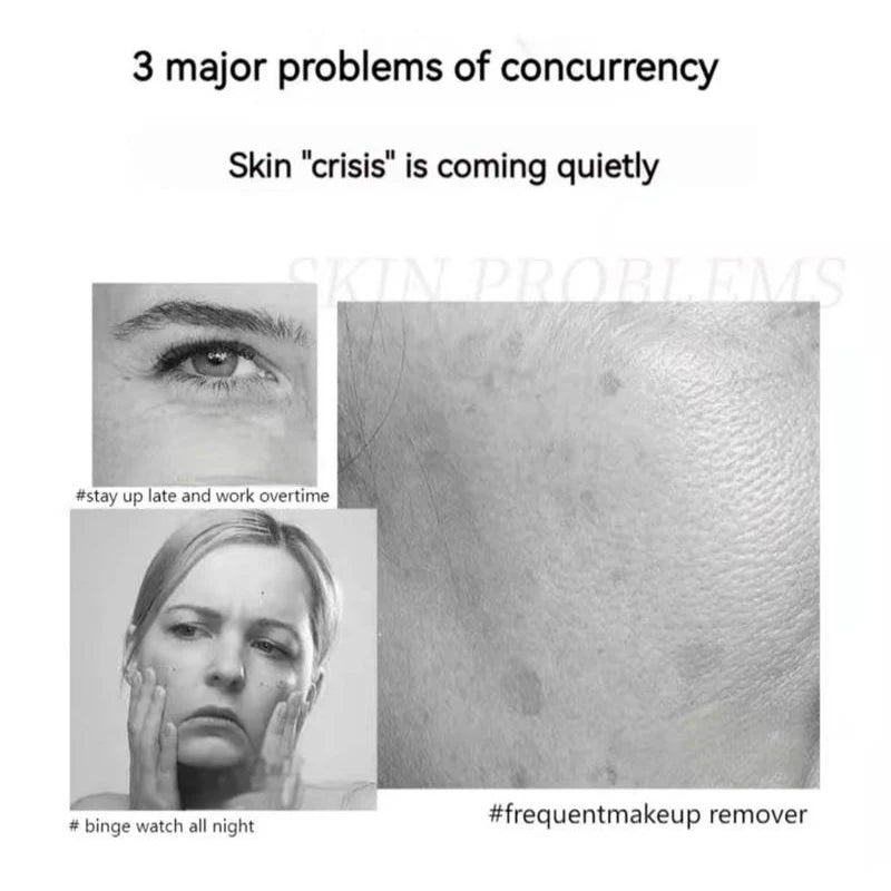 QINGLIN Polypeptide Firming Anti-Wrinkle Cream - Contains Peptides, Tocopherol, Sodium Amino Acid springtok - Specification: 1 bottle