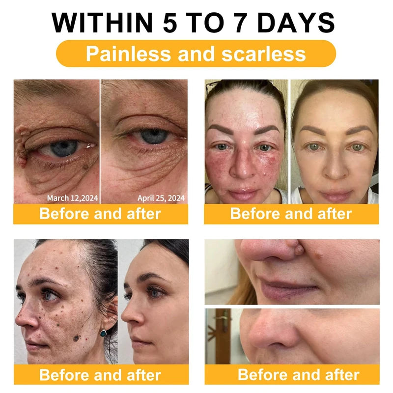 Bee Venom Comprehensive Cream, Professional Bee Venom Skin Treatment Cream for Removing and Repair, Natural Bee Venom Cream Suitable for All Skin Types (3PC)