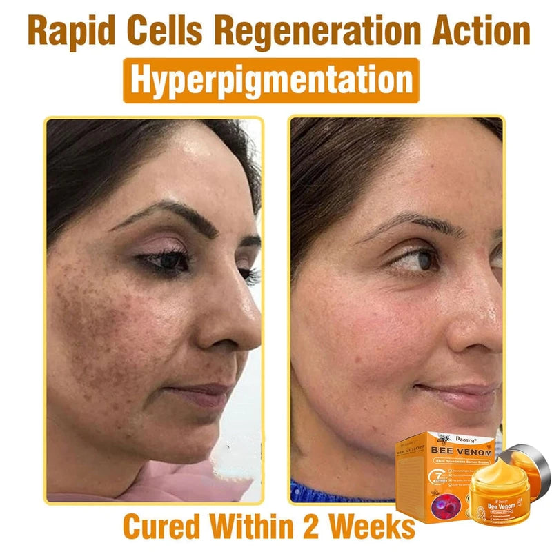 Daasry Bee Venom Skin Treatment Serum Cream, 2025 New Professional Bee Venom Skin Treatment Cream, Daasry Skin Repair Cream, Repair, moisturize and lift 3 in 1, for All Skin Types (3 Bottle)