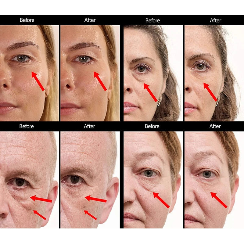 Under Eye Puffiness & Dark Circles Rapid Treatment- Instantly Reduces the Appearance of Puffy Eye Bags, Crow’s Feet, & Sagging Skin. Long Lasting Tightening & Firming Effect for Both Men & Women.