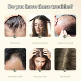 Ginger Anti Hair Loss Shampoo, Polygonum Multiflorum Ginger Plant Extract Anti-Hair Loss Hair Shampoo Ginger Hair Care Shampoo