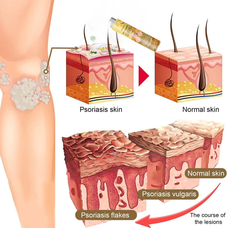 LOVILDS Bee Venom Spray - Remove Spots for Men Women, Bee Venom Spray, Bee Venom Skin Spray for All Parts of the Body (2PCS)